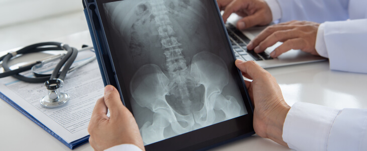 A doctor looks at an x-ray of a spine